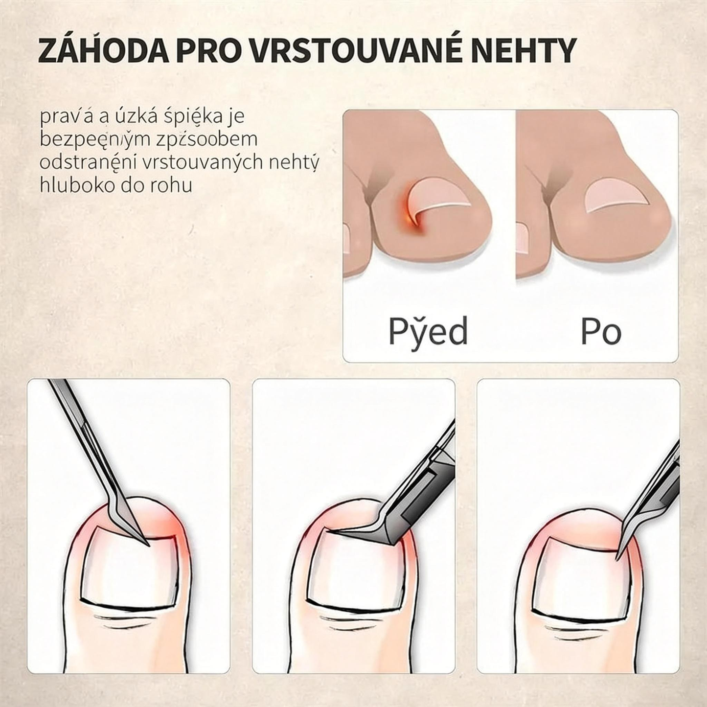 Speciálně navrženy pro seniory, nůžky na nehty proti stříkání , s lupou 🔍 pro přesné a bezpečné stříhání