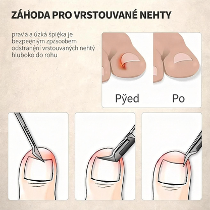 Speciálně navrženy pro seniory, nůžky na nehty proti stříkání , s lupou 🔍 pro přesné a bezpečné stříhání